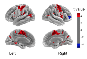 EEG/fMRI